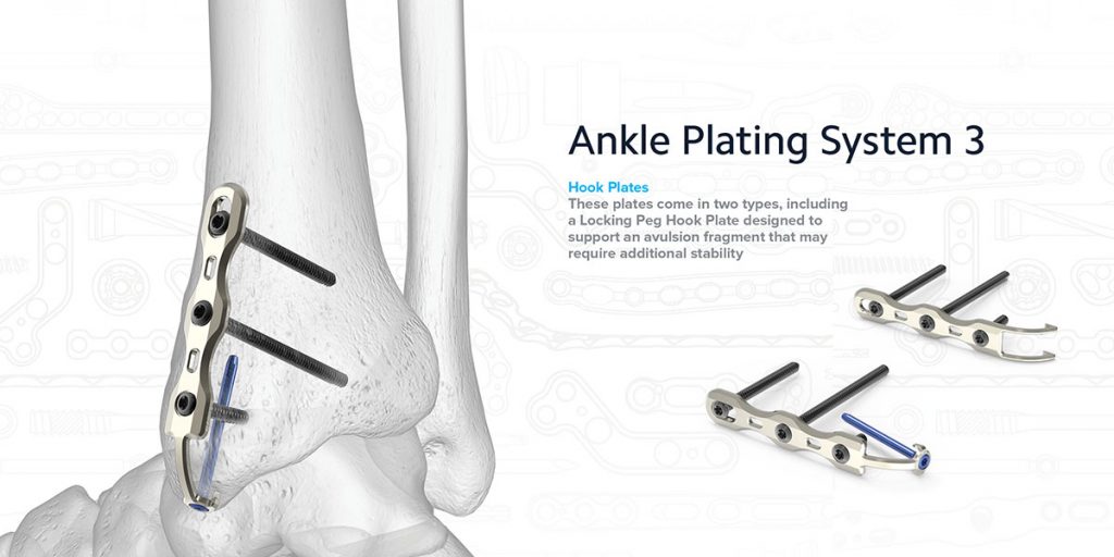 trauma-x-ray-lower-limb-ankle