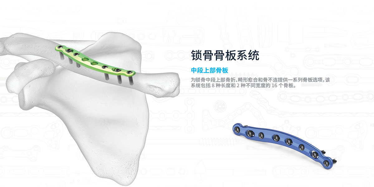 Midshaft Clavicle ZH | Acumed Information