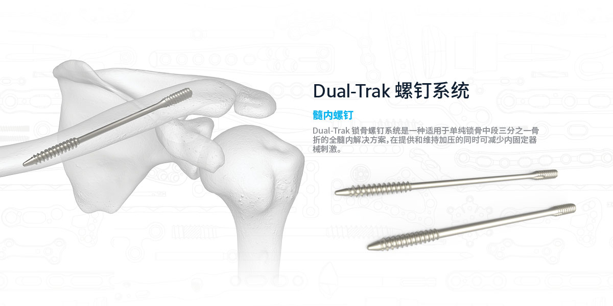 Midshaft Clavicle ZH | Acumed Information